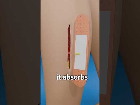 نحوه عملکرد بانداژ