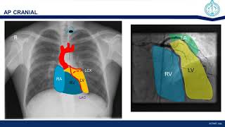 Fluroscopic anatomy of coronary arteries and ventricles