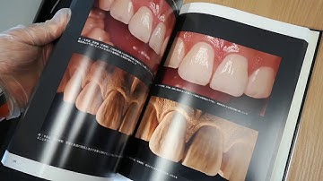 The Ultimate Guide to Tooth Morphology 1 and 2