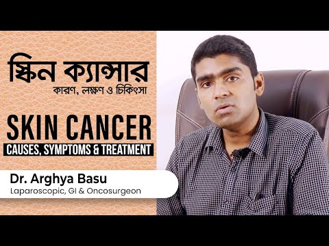 ভিডিও: কীভাবে একটি কেলয়েড নিরাময় করবেন (ছবি সহ)