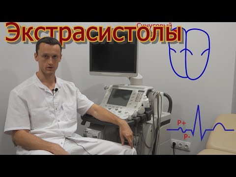 Экстрасистолия (экстрасистолы).
