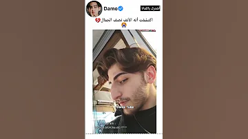 الأنف نصف جمال الوجه انصدمت Shorts 