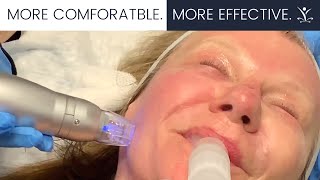 What Makes Scarlet SRF So Effective