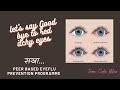 Let’s say Goodbye to Red Itchy Eyes