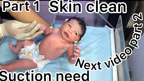 Newborn Baby Receive in Labor Room Suction Skin Cleaning with Liquid Paraffin NICU Care & Assessment