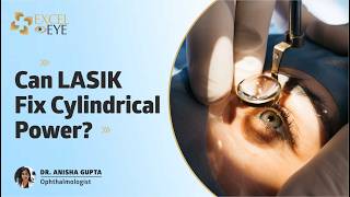 Can You Get LASIK with Cylindrical Power? Astigmatism Explained + LASIK Eligibility |Dr Anisha Gupta