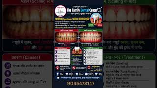 पायरिया - महत्वपूर्ण जानकारी / Bleeding from gums #bestdentistinaligarh