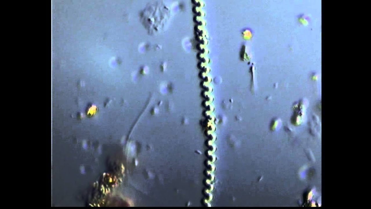 SPIRULINA bacterial transformation