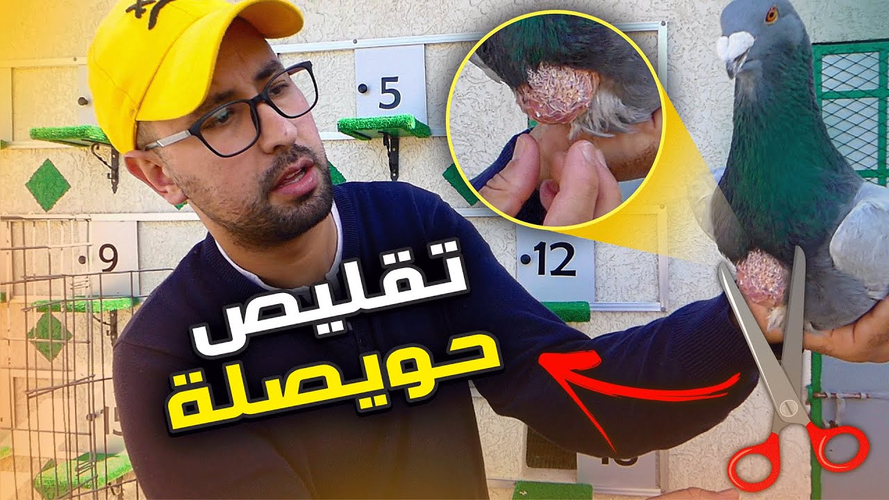 أسهل طريقة لي تقليص الحويصلة (البوتشي) | شاهد النتيجة 😳