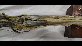 Posterior compartment of Leg - Part 1