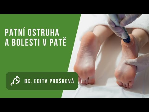 Video: Jak Tisknout Ostruhy