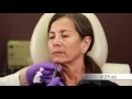 Voluma Chin Video 720