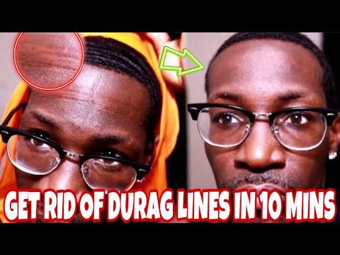 【How to】 Get rid Of Lines On Forehead From Durag
