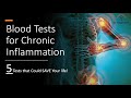 Best tests for chronic inflammation 5 tests that could save your life