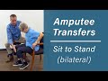 Getting Up Out of a Chair: Sit-to-Stand Transfer for Bilateral Amputees
