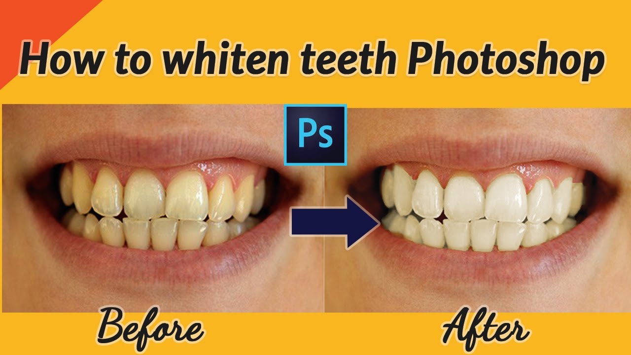 How to whiten teeth YouTube