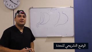 شرح عملية تكميم المعدة مع الدكتور محمد خلف