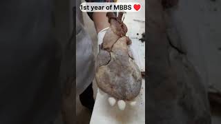 life after neet ?and 1st year of MBBS♥️ trendingviralmbbsshorts