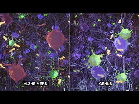GENUS: Research on sensory stimulation to combat Alzheimer&#039;s disease