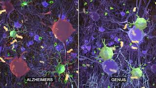 GENUS: Research on sensory stimulation to combat Alzheimer's disease