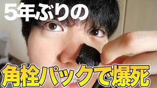角栓動画で100万再生した男が4年越しのリベンジに..! 微細カメラも加えて毛穴の隅々まで観察した!