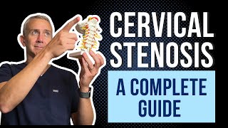 Cervical Spine Stenosis  A Complete Guide