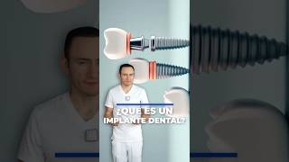 ¿Qué es un implante dental? Te lo explico en un minuto.