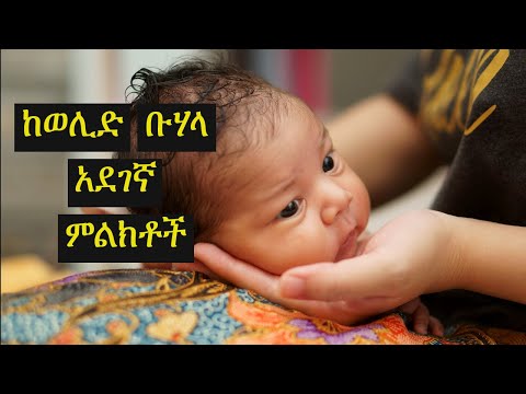 ቪዲዮ: የድህረ -ጉዞ ምርመራዎች ያስፈልጋሉ?