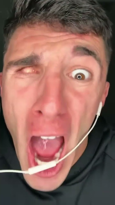 Download lagu My eye ball slpped out #shorts😂