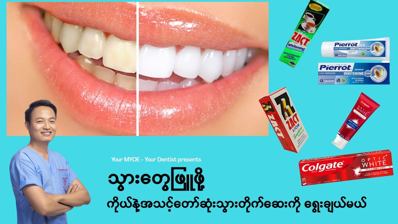 သွားတွေဖြူဖို့ ကိုယ်နဲ့အသင့်တော်ဆုံးသွားတိုက်ဆေး