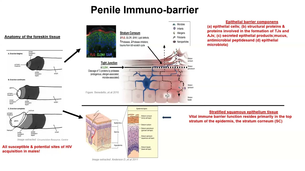 The Impact of Asymptomatic STIs on Penile Mucosal Immunity