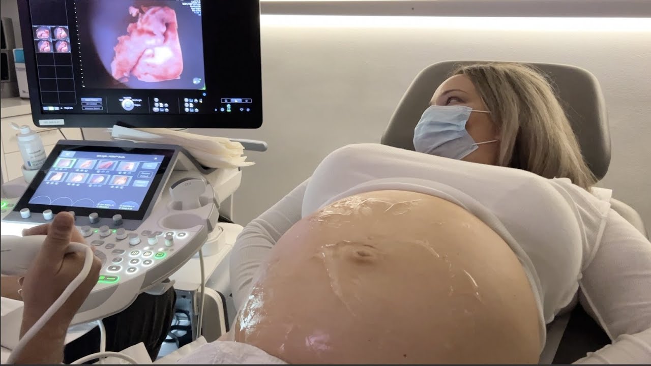 37 week ultrasound - cutest baby cheeks and eyelashes!