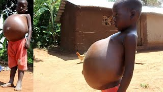 Six year old child weighs 100kgs.His story shocks everyone.HELP IVAN on mobile money 0706410354