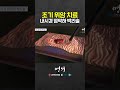 내시경을 통해 암세포만 제거! 조기 위암 치료 Mp3 Song