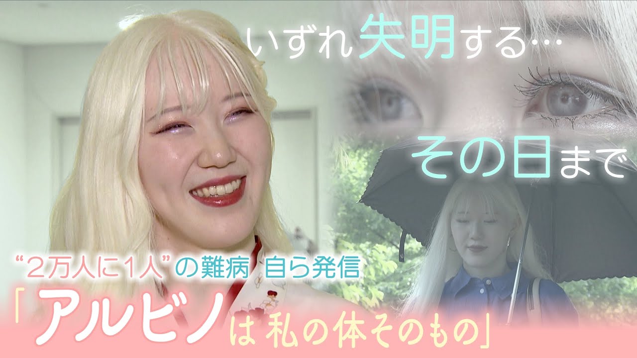2万人に1人　アルビノの女性　りり香さん22歳　障害に負けずに自分自身を発信　強く生きるその姿