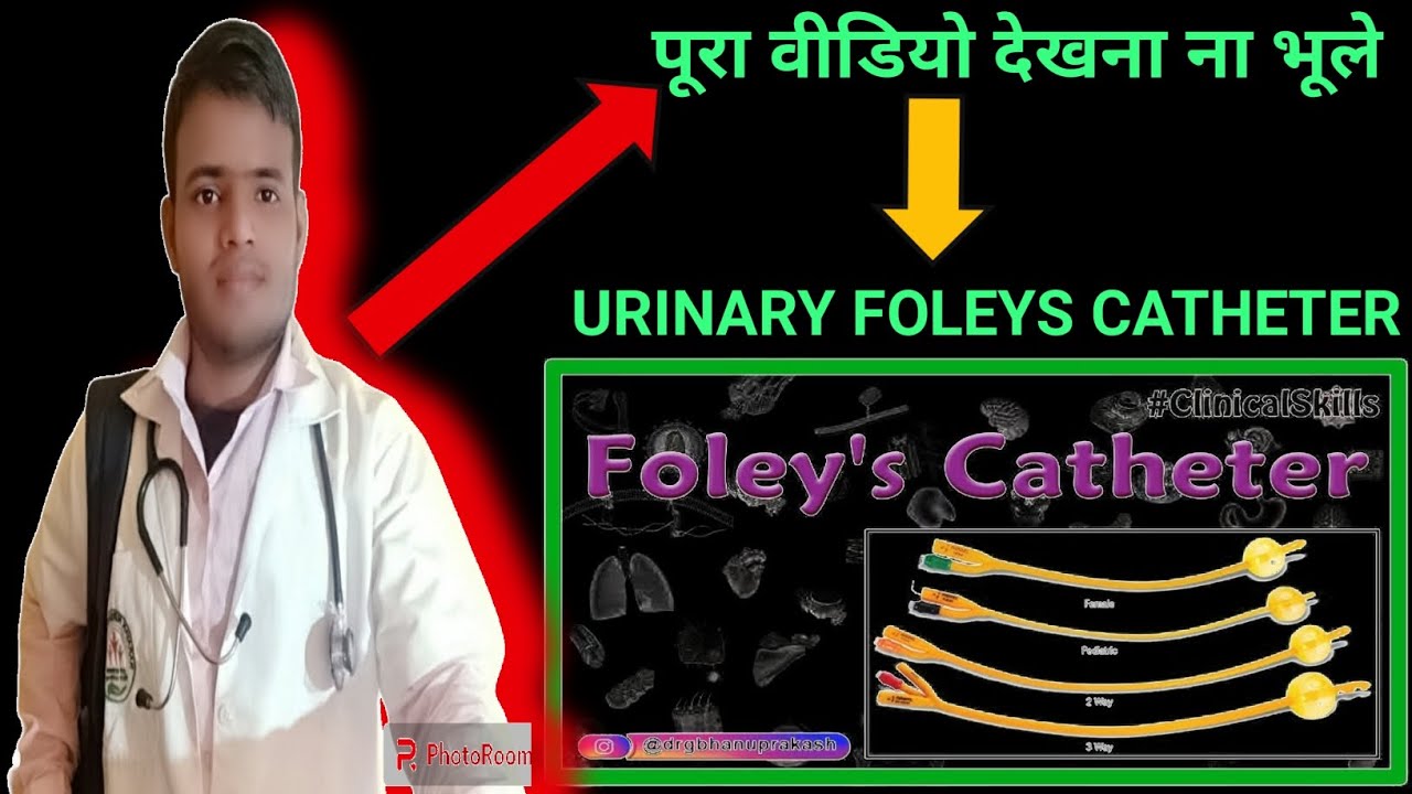 Use of foleys catheter, what is foleys catheter, who is foleys catheter