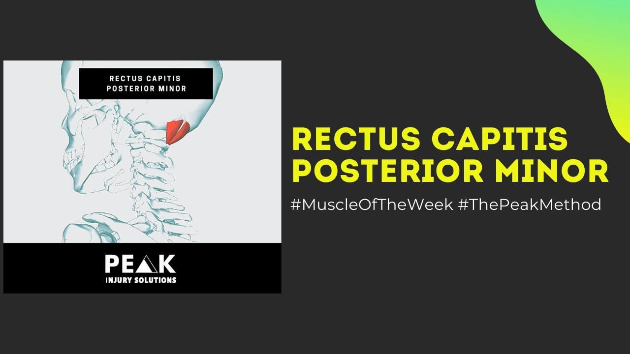 Muscle Of The Week Breakdown: Rectus Capitis Posterior Minor