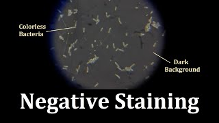 Bacterial Negative staining