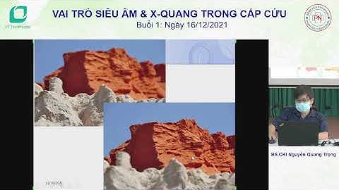 SIÊU ÂM TRONG CẤP CỨU  [ BUỔI 1 ]