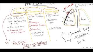 Information Pneumothorax ,Spontaneous ,Traumatic and Tension Pneumothorax Guide