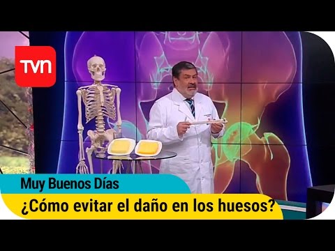 Muy buenos días | ¿Cómo evitar el daño en los huesos?