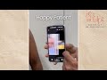 Gynecomastia Patient Review | Gyencomastia Surgery | Gynecomastia Surgery Before and After