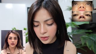 BIGGEST REGRET IN MY LIFE? (Rhinoplasty Journey Pt.2) | Mika Salamanca screenshot 4