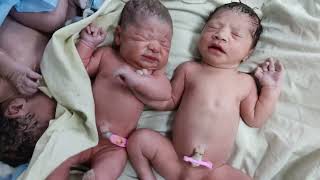 Chubby twins after birth whose third partner was yet to be delivered