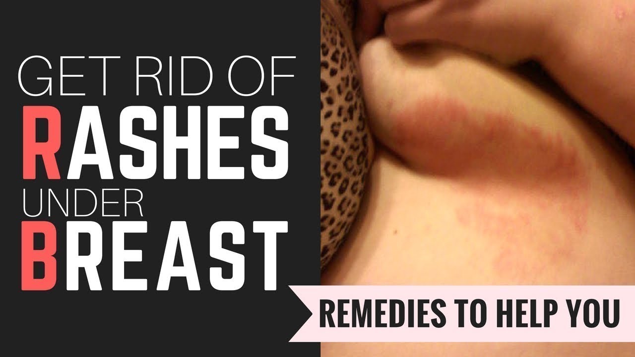 Rash Under Breast: How To Get Rid Of Red Itchy Rash Under Breast
