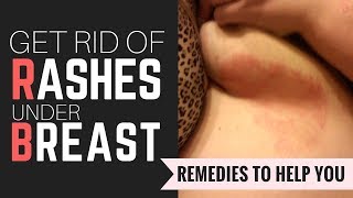 Rash Under Breast: How to Get Rid of Red Itchy Rash Under Breast