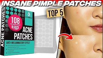 Top 5: Best Pimple Patches to Get Rid of Acne Fast
