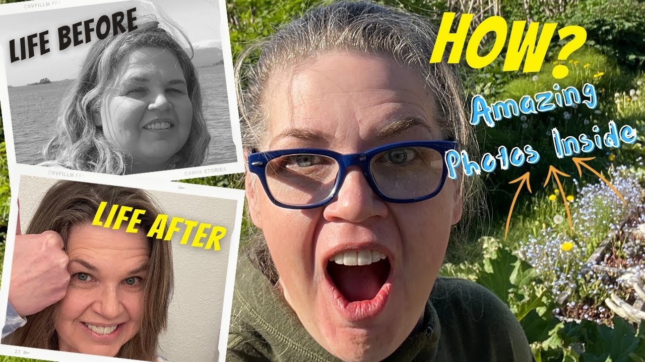 Life Skills for Bariatric Surgery | How I Improved My Life! (Vlog Style)