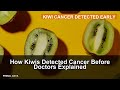 How Kiwis Detected Cancer Before Doctors Explained