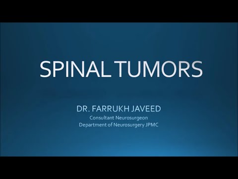 Spinal Cord Tumors Lecture